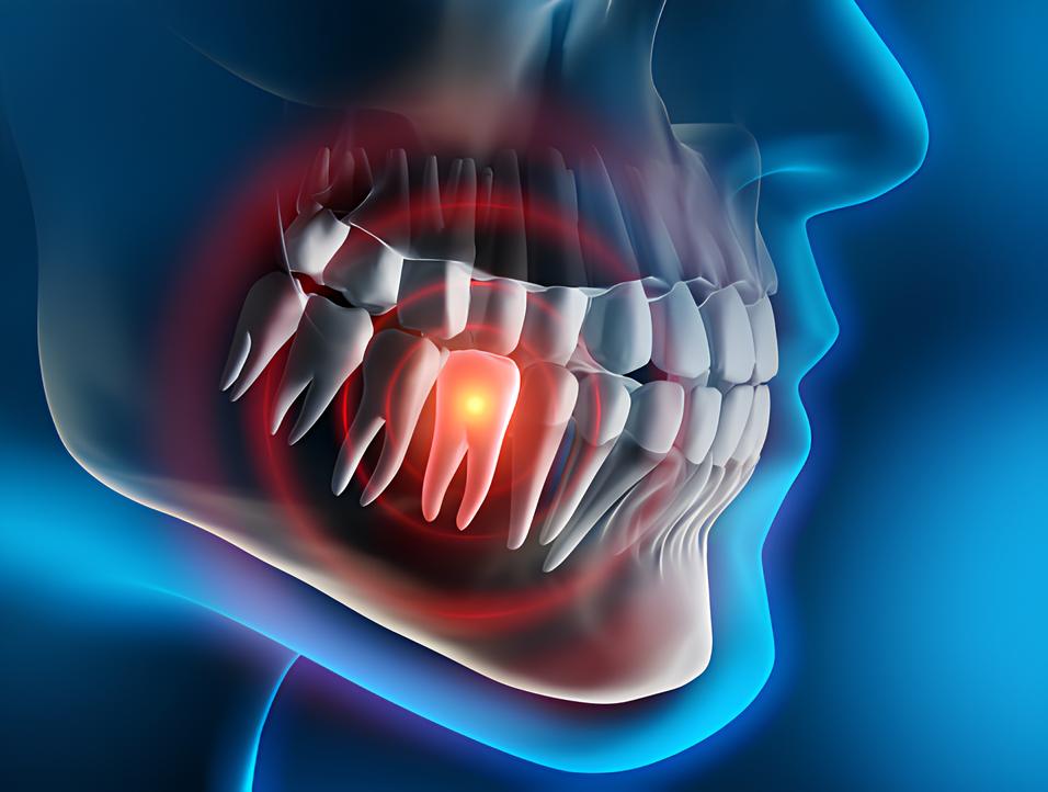 Teeth image - Emergency dentist Canterbury